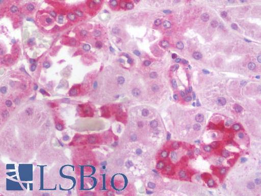 Anti-TYK2 antibody IHC staining of human kidney. Immunohistochemistry of formalin-fixed, paraffin-embedded tissue after heat-induced antigen retrieval. Antibody LS-B10071 concentration 10 ug/ml.