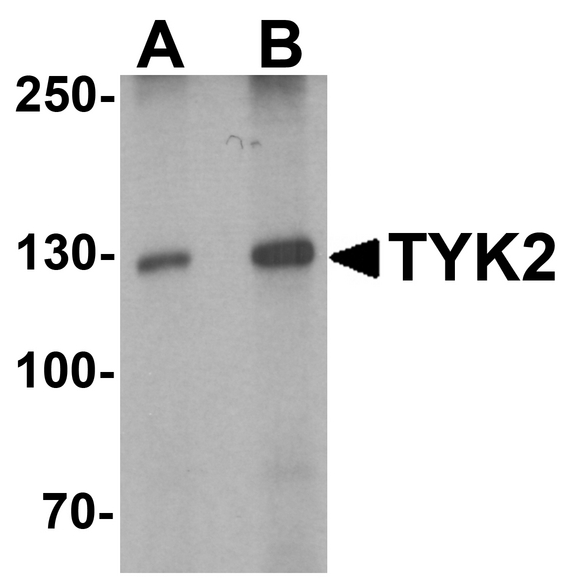 Western blot analysis of TYK2 in human small intestine tissue lysate with TYK2 antibody at (A) 1 and (B) 2 ug/ml