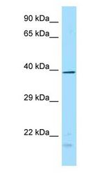 TYP / DUSP4 antibody Western Blot of Fetal Brain.