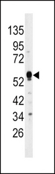 Western blot of anti-DUSP4 Antibody in HepG2 cell line lysates (35 ug/lane). DUSP4 (arrow) was detected using the purified antibody.