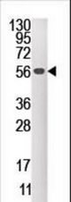 Western blot of anti-DUSP4 antibody in mouse brain tissue lysate (35 ug/lane). DUSP4(arrow) was detected using the purified antibody.