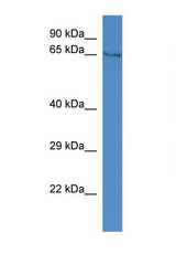 TYRP1 /gp75 antibody LS-C135160 Western blot of Rat Brain lysate. Antibody concentration 1 ug/ml.