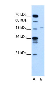 TYRP1 /gp75 antibody LS-C40470 Western blot of Jurkat lysate.