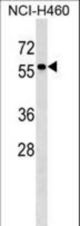 TYRP1 Antibody western blot of NCI-H460 cell line lysates (35 ug/lane). The TYRP1 antibody detected the TYRP1 protein (arrow).