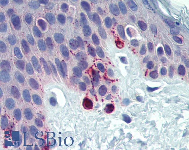 Anti-TYRP1 /gp75 antibody IHC of human skin. Immunohistochemistry of formalin-fixed, paraffin-embedded tissue after heat-induced antigen retrieval. Antibody LS-B4011 concentration 5 ug/ml.