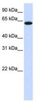 Western blot of 721_B Cell Lysate.