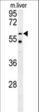 TYSND1 Antibody western blot of mouse liver tissue lysates (15 ug/lane). The TYSND1 antibody detected TYSND1 protein (arrow).