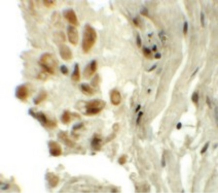 Immunohistochemistry of TYW1 in human lung tissue with TYW1 antibody at 5 ug/ml.