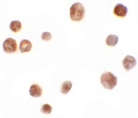 Immunocytochemistry of TYW2 in K562 cells with TYW2 antibody at 10 ug/ml.