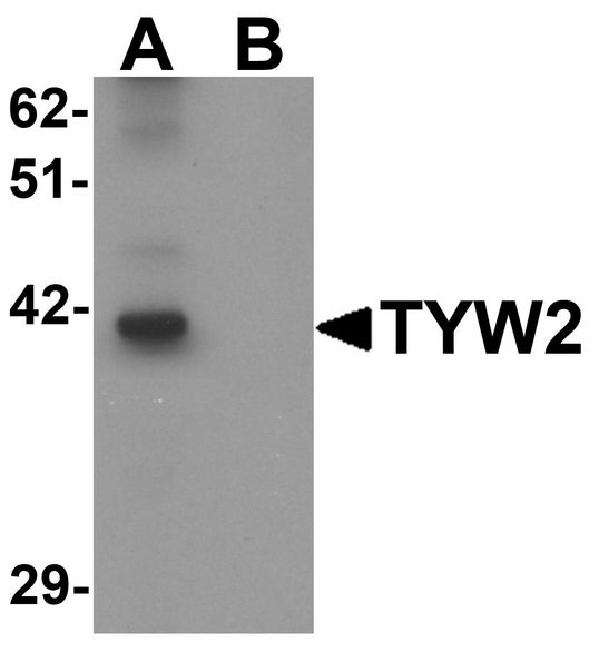 Western blot analysis of TYW2 in K562 cell lysate with TYW2 antibody at 0.5 ug/ml in (A) the absence and (B) the presence of blocking peptide.
