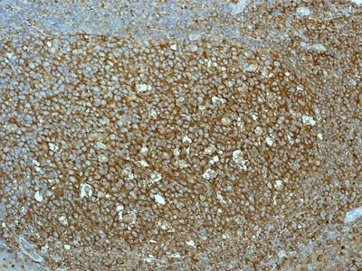IHC of paraffin-embedded human tonsil tissue using anti-EHD1 antibody.