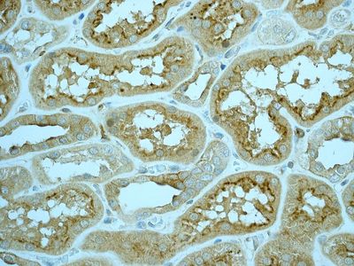 IHC of paraffin-embedded human kidney tissue using anti-EHD1 antibody.