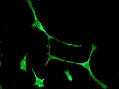 Immunofluorescent staining of HeLa cells using anti-EHD1 antibody.