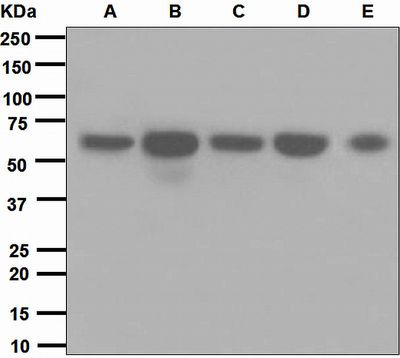 Western blot analysis on (A) HepG2, (B) human testis, (C) SW480, (D) SK-OV-3, and (E) HeLa lysates using anti-EHD1 antibody.