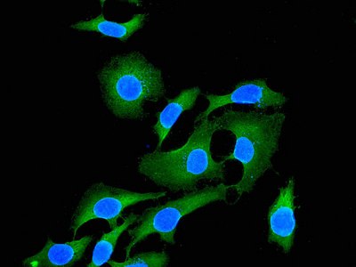 Immunofluorescent staining of HeLa cells using anti-EHD1 antibody.