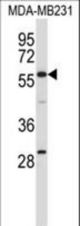 EHD1 Antibody western blot of MDA-MB231 cell line lysates (35 ug/lane). The EHD1 antibody detected the EHD1 protein (arrow).