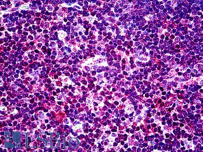 Anti-EHD1 antibody IHC of human thymus. Immunohistochemistry of formalin-fixed, paraffin-embedded tissue after heat-induced antigen retrieval. Antibody LS-B5111 concentration 3.75 ug/ml.