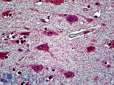 Anti-EHD1 antibody IHC of human brain, cortex. Immunohistochemistry of formalin-fixed, paraffin-embedded tissue after heat-induced antigen retrieval. Antibody LS-B5111 concentration 3.75 ug/ml.