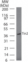 Western blot of Tin2 in Daudi cell lysate using antibody at 2 ug/ml.