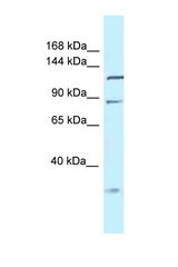 Tmem132d antibody LS-C145604 Western blot of Mouse Liver lysate. Antibody concentration 1 ug/ml.