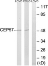 Western blot of extracts from COLO/LOVO cells, using CEP57 Antibody. The lane on the right is treated with the synthesized peptide.