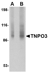 Western blot of TNPO3 in rat liver tissue lysate with TNPO3 antibody at (A) 1 and (B) 2 ug/ml.