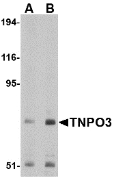 Western blot of TNPO3 in Raji cell lysate with TNPO3 antibody at (A) 1 and (B) 2 ug/ml.