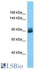Transportin-SR / TNPO3 antibody Western Blot of MCF7. Antibody dilution: 1 ug/ml.