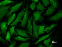 Immunostaining analysis in HeLa cells. HeLa cells were fixed with 4% paraformaldehyde and permeabilized with 0.1% Triton X-100 in PBS. The cells were immunostained with anti-TNPO3 mAb.