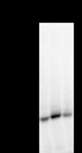 Detection of TNPO3 by Western blot. Samples: Whole cell lysate from human HEK293 (H, 25 ug) , mouse NIH3T3 (M, 25 ug) and rat F2408 (R, 25 ug) cells. Predicted molecular weight: 104 kDa