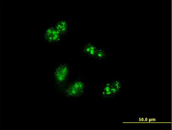 Immunofluorescence of monoclonal antibody to TCOF1 on HeLa cell . [antibody concentration 10 ug/ml]