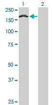 Western Blot analysis of TCOF1 expression in transfected 293T cell line by TCOF1 monoclonal antibody (M02), clone 8H3.Lane 1: TCOF1 transfected lysate(152.104 KDa).Lane 2: Non-transfected lysate.
