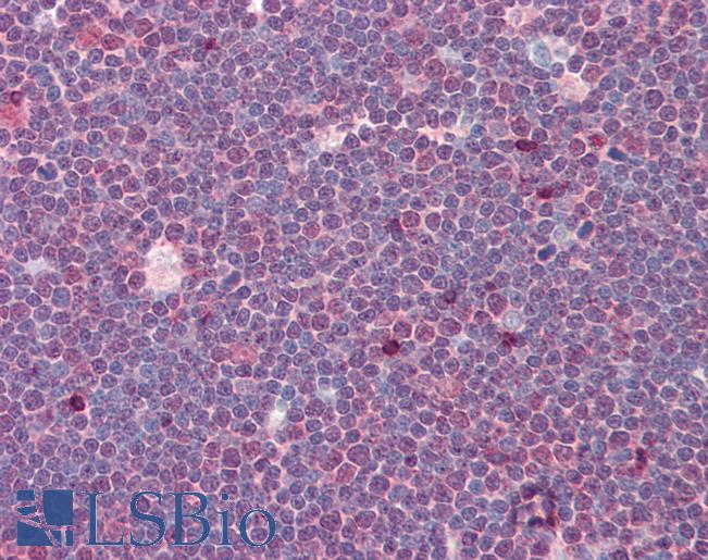 Anti-Treacle / TCOF1 antibody IHC of human thymus. Immunohistochemistry of formalin-fixed, paraffin-embedded tissue after heat-induced antigen retrieval. Antibody LS-B8409 dilution 5 ug/ml.