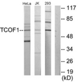 Western blot of extracts from Jurkat/293/HeLa cells, using TCOF1 Antibody. The lane on the right is treated with the synthesized peptide.