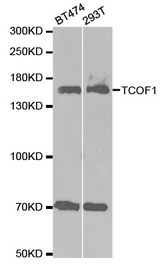 Western blot analysis of extracts of various cell lines, using TCOF1 antibody.