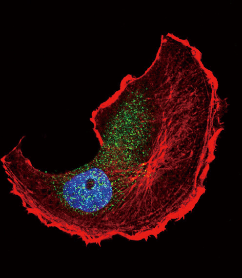 Confocal immunofluorescent of Phospho-TSC2-S1798 Antibody with MCF-7 cell followed by Alexa Fluor 488-conjugated goat anti-rabbit lgG (green). Actin filaments have been labeled with Alexa Fluor 555 phalloidin (red). DAPI was used to stain the cell nuclear (blue).