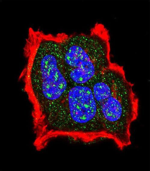 Confocal immunofluorescent of Phospho-TSC2-S1420 Antibody with MCF-7 cell followed by Alexa Fluor 488-conjugated goat anti-rabbit lgG (green). Actin filaments have been labeled with Alexa Fluor 555 phalloidin (red). DAPI was used to stain the cell nuclear (blue).