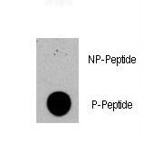 Dot blot of anti-TSC2-pS1420 Phospho-specific antibody (RB13391) on nitrocellulose membrane. 50ng of Phospho-peptide or Non Phospho-peptide per dot were adsorbed. Antibody working concentrations are 0.5ug per ml.