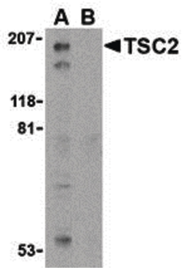 Western blot of TSC2 in L1210 cell lysate with TSC2 antibody at 1 ug/ml in the (A) absence and (B) presence of blocking peptide.