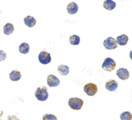Immunocytochemistry of TSC2 in L1210 cells with TSC2 antibody at 10 ug/ml.