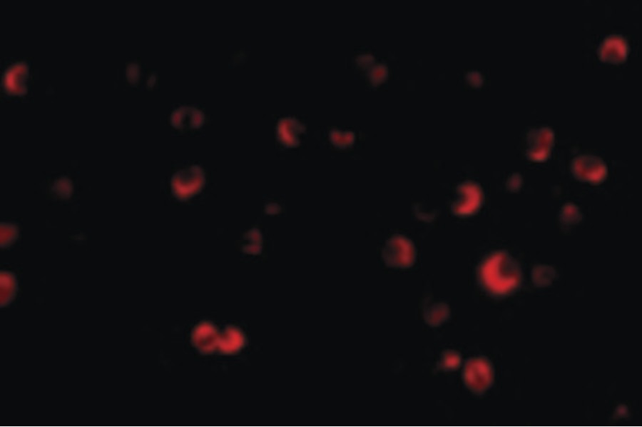 Immunofluorescence of TSC2 in L1210 cells with TSC2 antibody at 20 ug/ml.