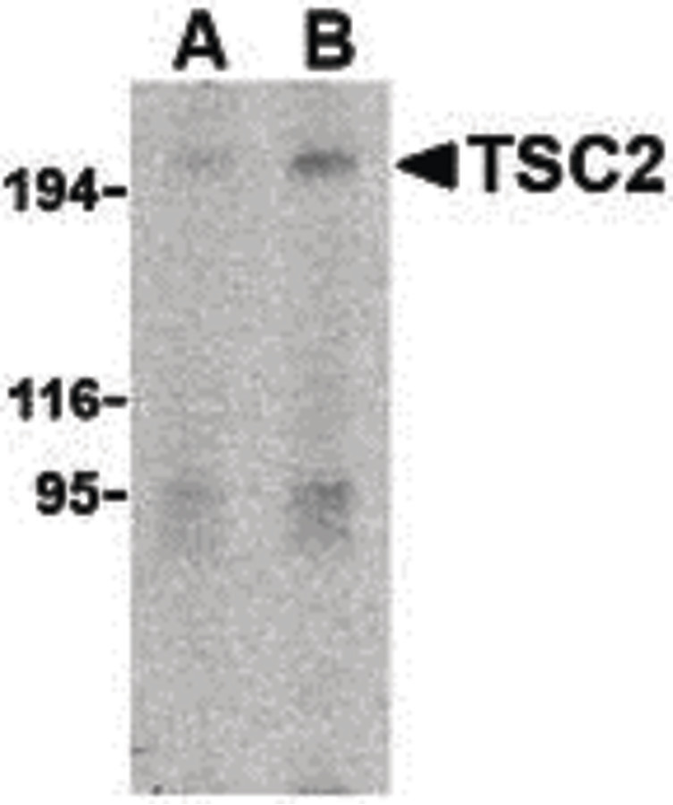 Western blot of TSC2 in L1210 cell lysate with TSC2 antibody at (A) 2 and (B) 4 ug/ml.