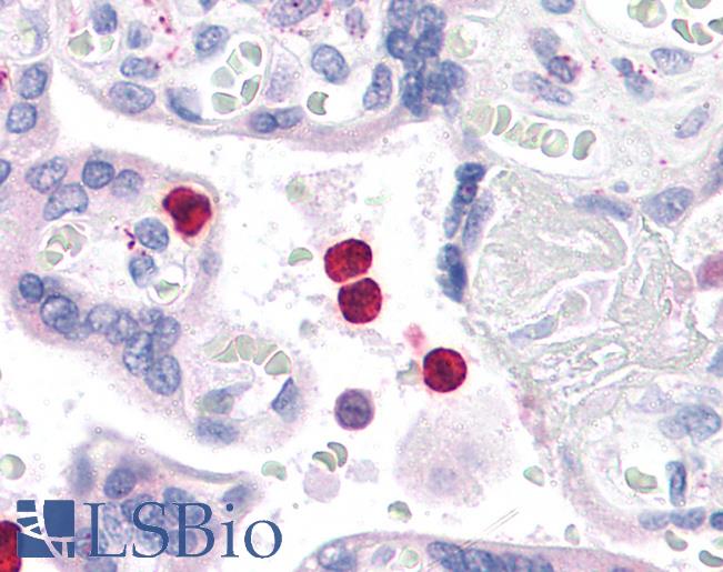 Anti-TLR4 antibody IHC of human neutrophils. Immunohistochemistry of formalin-fixed, paraffin-embedded tissue after heat-induced antigen retrieval. Antibody LS-B4696 concentration 5 ug/ml.
