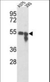 Western blot of Tyrosinase Antibody in A375, 293 cell line lysates (35 ug/lane). Tyrosinase (arrow) was detected using the purified antibody.