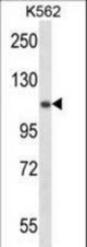 UBA1 Antibody western blot of K562 cell line lysates (35 ug/lane). The UBA1 antibody detected the UBA1 protein (arrow).