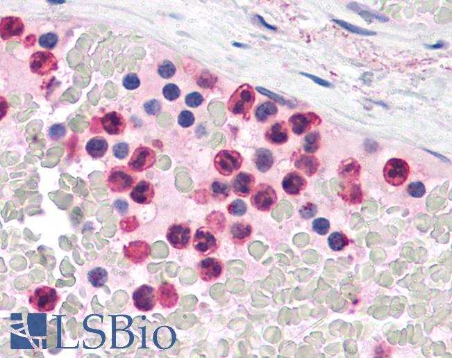 Anti-TLR4 antibody IHC of human neutrophils. Immunohistochemistry of formalin-fixed, paraffin-embedded tissue after heat-induced antigen retrieval. Antibody LS-B4696 concentration 5 ug/ml.