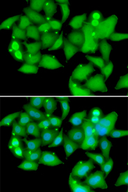 Immunofluorescence blot of A549 cell using UBASH3B antibody. Blue: DAPI for nuclear staining.