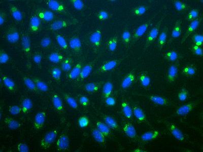 Immunofluorescent staining of aggresomes of mouse L-cells treated with lactacysteine.