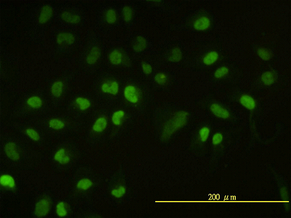 Immunofluorescence of monoclonal antibody to UBE2H on HeLa cell. [antibody concentration 10 ug/ml]