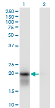 Western Blot analysis of UBE2H expression in transfected 293T cell line by UBE2H monoclonal antibody (M01), clone 3C4-1A2.Lane 1: UBE2H transfected lysate(20.7 KDa).Lane 2: Non-transfected lysate.
